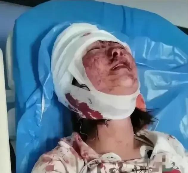 女暴徒不值得同情,灰衣女太伟大,曝光者有勇气