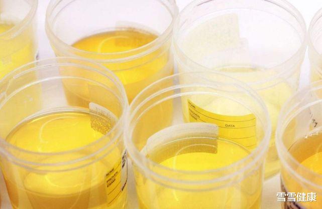 蝴蝶|晨起一杯“毒开水”,61岁大叔肾衰离世,医生:无知害人不浅