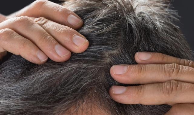 白发|白发越长越多?送你三招,让头发重回少年时