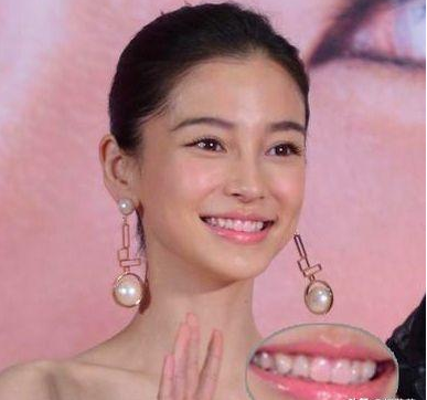 Angelababy|哪些明星“出糗”的瞬间，能承包你一年的笑点？