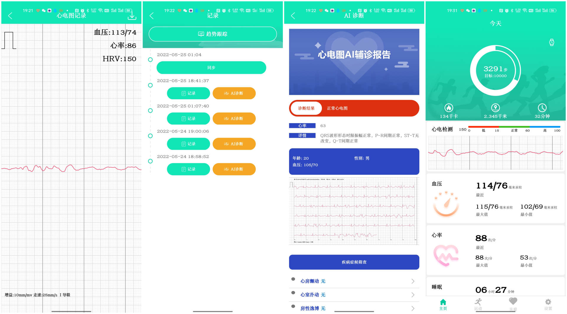 dido|智能手表新方向，手腕上的健康监测器，dido血压智能手表E10体验