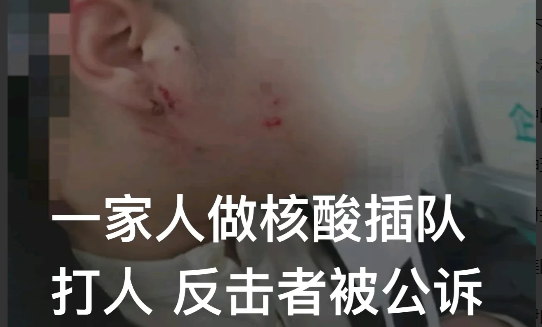 辽宁大连,李先生下楼排队做核酸,好不容易等到自己,前面突然插进来几个人