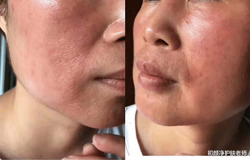 洗发水 屏障修复很难?关键点在这!