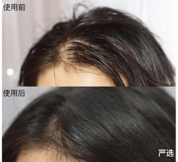 洗发水|三种早已进入“黑名单”的洗发水,价钱贵还掉发,很多人都用过