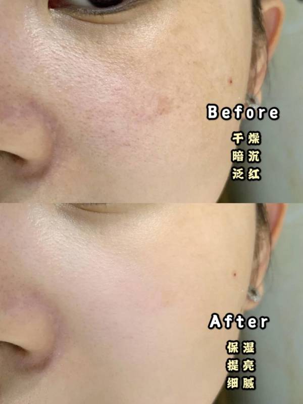 秦海璐|秦海璐“素颜”皮肤好到“没毛孔”,分享自用多年的护肤神器,白鹿:好用到爆