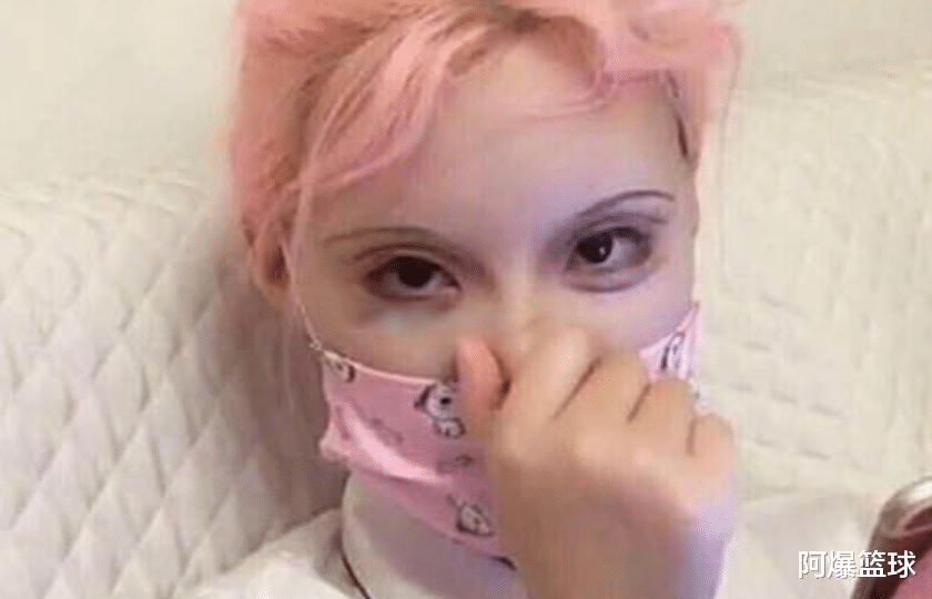 整容|迪丽拉整容一百多次, 医生估计都不敢再给他动刀