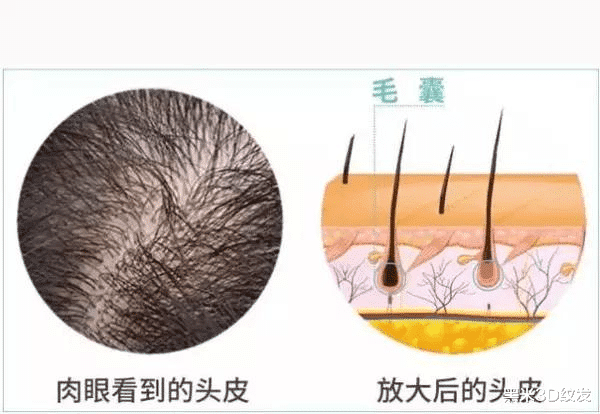 肠胃|脱发知识普及;脱发就表示毛囊坏死了吗?