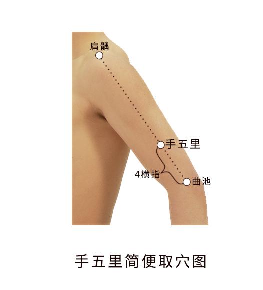 肾结石|神奇的手五里穴,舒筋活络治疗关节痛的要穴