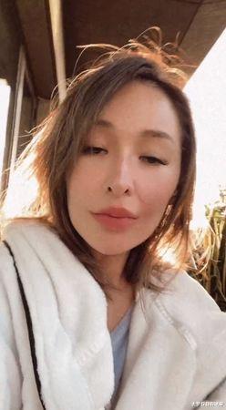 萧亚轩|萧亚轩曝右脸伤疤“像少一块肉”:我爱我自己!遭疑要当张惠妹嘉宾