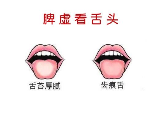 艾灸|为什么现在不少人会脾虚？平时生活怎么调理？