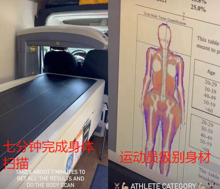 卡戴珊|“阔太”卡戴珊用激光缩胃！肚皮通红一大片，自曝脂肪集中在臀部