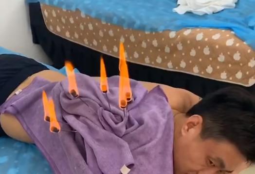 针灸|钓鱼人还要不要玩长竿，邓刚因伤宣布退赛，刘松松一脸销魂做针灸