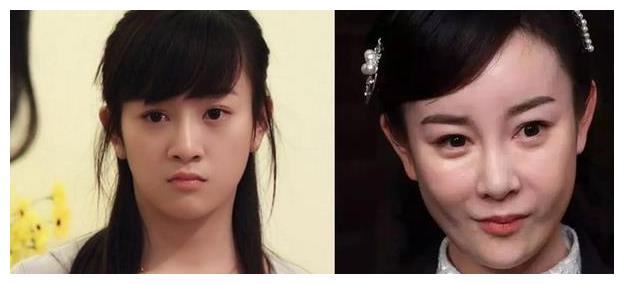 脸没恢复就别接戏了，“馒头脸蛋”演啥都拉胯，这些女星不羞吗
