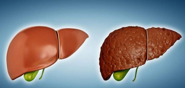 中药|98岁肝胆科院士:天然“护肝王”被揪出,为了家人健康,建议收藏