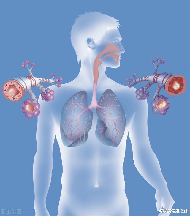 慢阻肺|慢性病与肠道菌群有关又添证据，研究发现慢阻肺患者肠道菌群失调