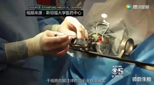 30 岁后每十年一道坎儿,干细胞技术帮你征服人生每一道病坎!