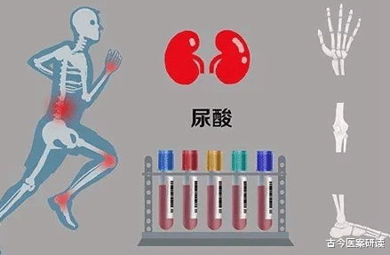 衰老|嘌呤“大户”被揪出，是海鲜10倍，医生坦言：再不戒掉，肾衰迟早上门