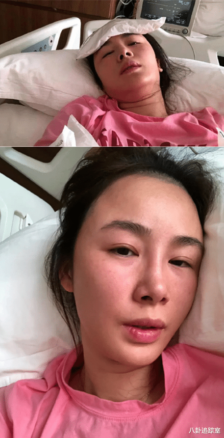 梅婷|梅婷前夫带重病妻子求医！妻子2年做2次要命手术，网友：男的克妻