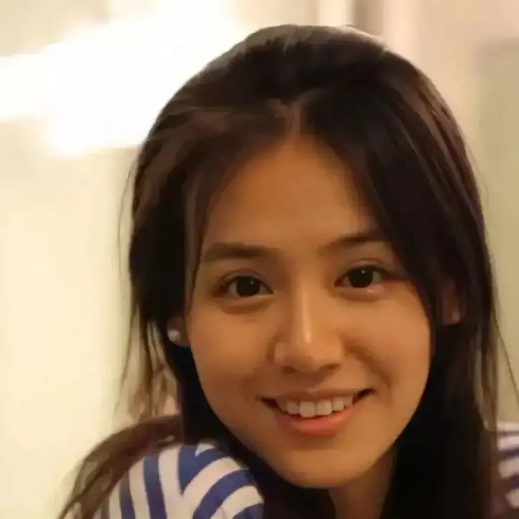 医美|出道即惊艳众人,现在却灵气全无,是花期太短还是医美太过?