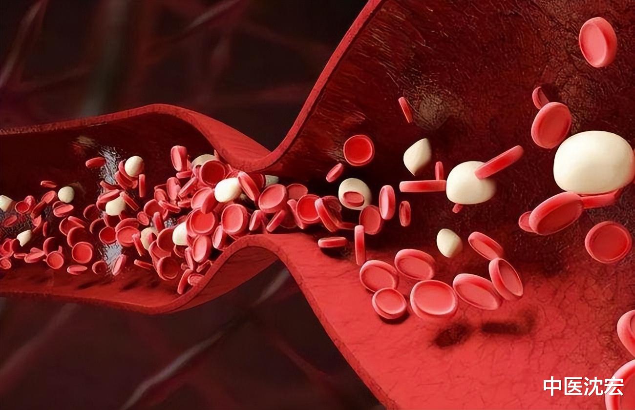 牙齿|瘀血一通，百病无踪，一个中成药，活血化瘀，疏通一身淤血