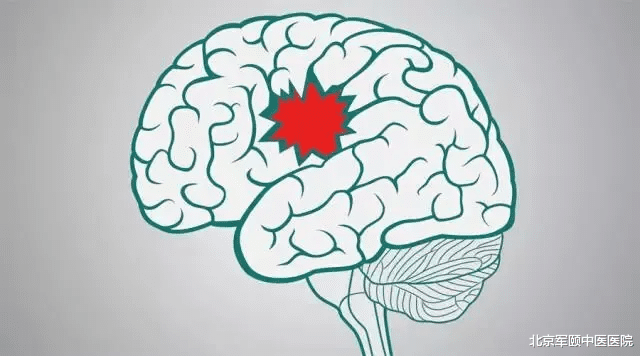 坚果|中老年人要警惕:不要让你的脑子“卒”不及防!!