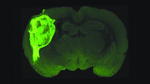 美科学家最新研究,将人类“迷你大脑”成功植入老鼠体内