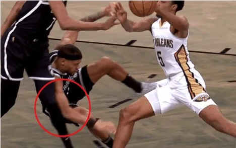 阿杜|完了，芭比Q了！阿杜受傷，和4年前一樣可怕?。?
onload=