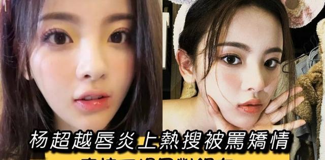 杨超越|杨超越唇炎上热搜被骂矫情!直接下场回怼网友!美女实惨!