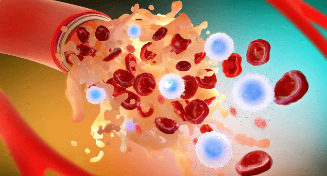 肾衰竭|5大危险因素会加速肾衰竭！肾友抓紧纠正，一个没占最好