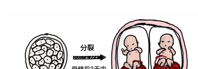 子宫内把8个兄妹“吞噬”，印度女婴出生体内8个寄生胎，全球罕见