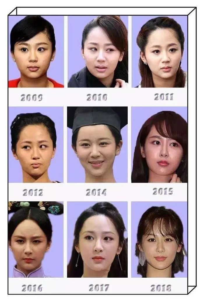 陈瑶|荧幕上倾世容颜，私底下跟鬼一样，干瘪、病态、脸僵，真打脸