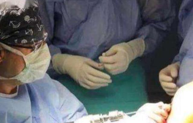 迪士尼|曾花16万断骨,只为长高7.2厘米的李亚诺,如今与后遗症为伴