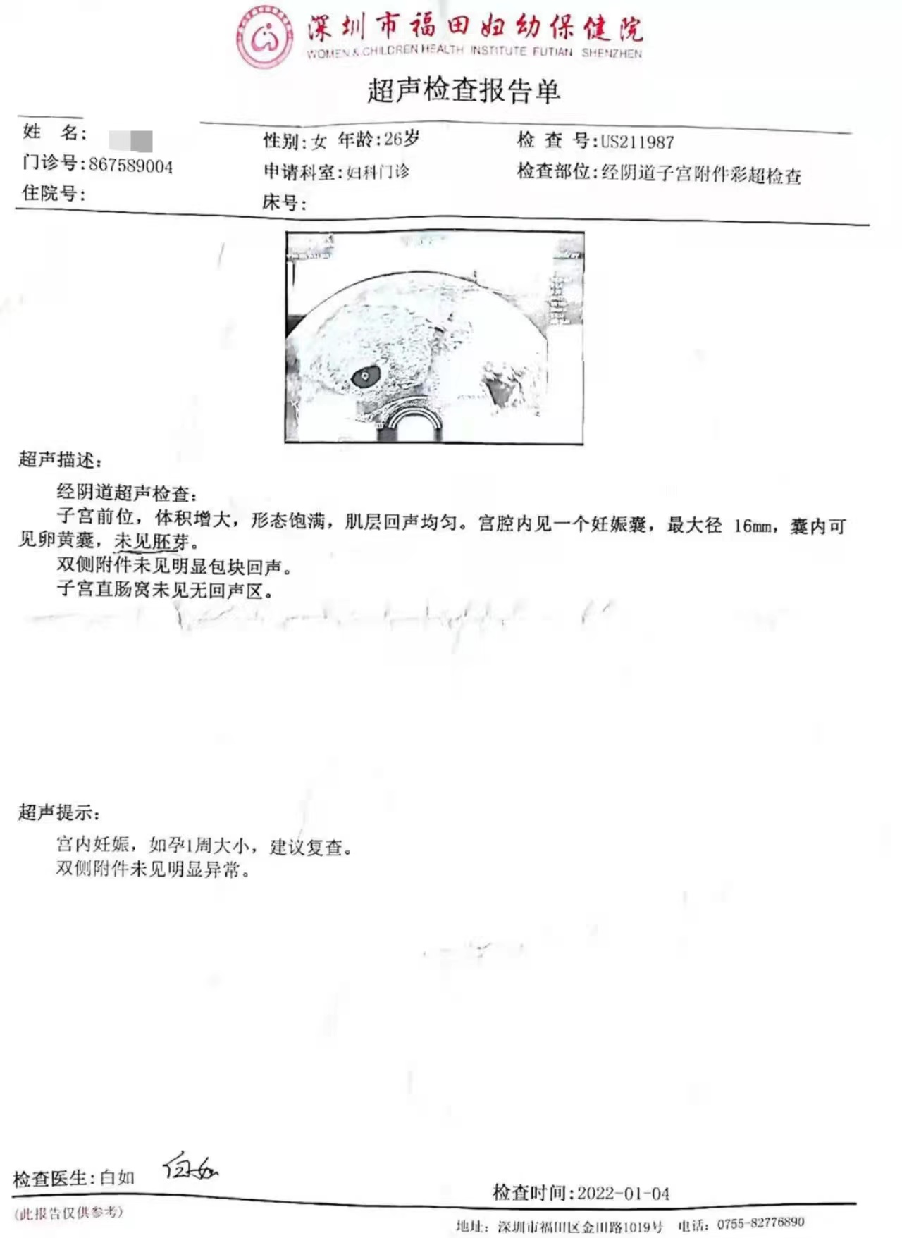 纹眉 抽脂手术前女子发现怀孕欲退费，派壹特医美：钱不退，留着下次用