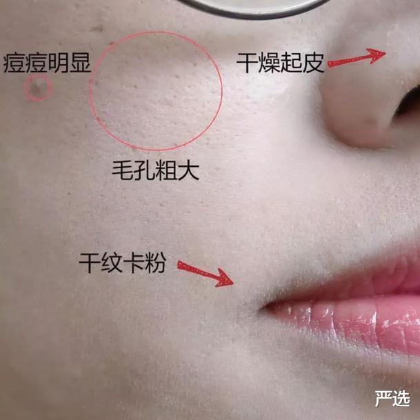 长裙 为什么不建议女人“总用”粉底液?“2个”原因,现在知道还不晚