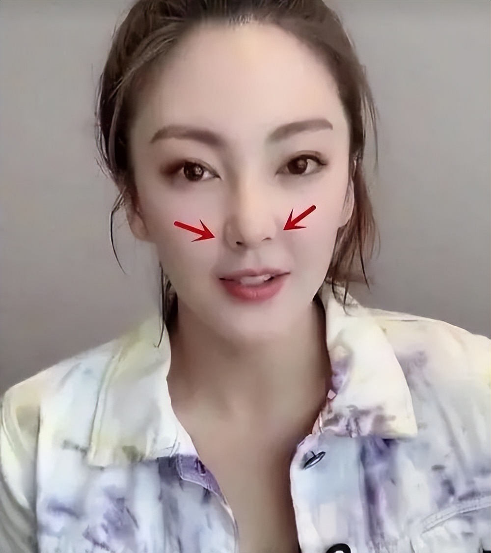 整容|年纪轻轻就眼歪嘴斜的5位明星，有的是天生遗传，有的是整容过度