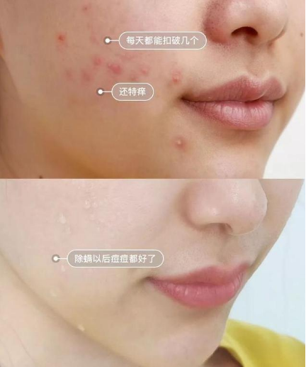 护肤 李小冉“护肤秘诀”火了，轻松养成光滑婴儿肌，金晨：我都用2年了