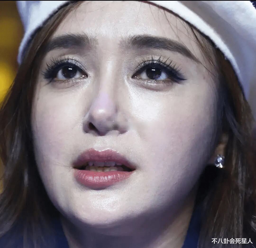 陈亚男|果然露馅了!凹陷、鼻梁中断,14位明星暴露动脸痕迹,看得心惊!