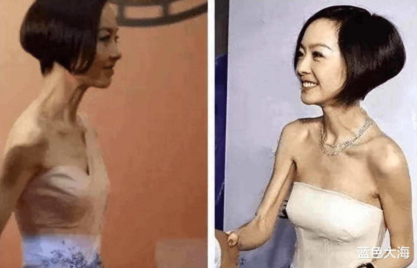 明星 为了上镜疯狂减肥的7位明星,实则越瘦越难看