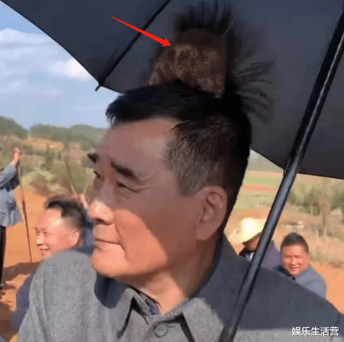 李一桐|李一桐崩牙后,为不影响录制用502粘牙被夸敬业,专家:不建议