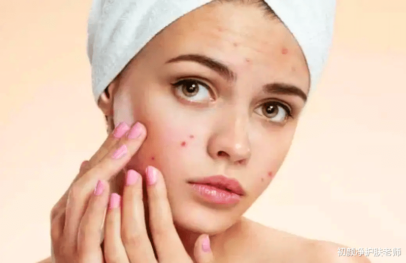 米饭 普通痘痘VS不普通痘痘,这点真的很重要!