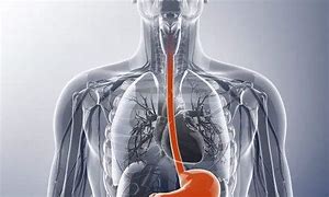 食管癌|食管癌患者应做哪些护理?