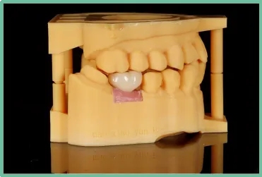 aiot|3D打印在口腔领域上的应用会在未来有明显的体现吗?