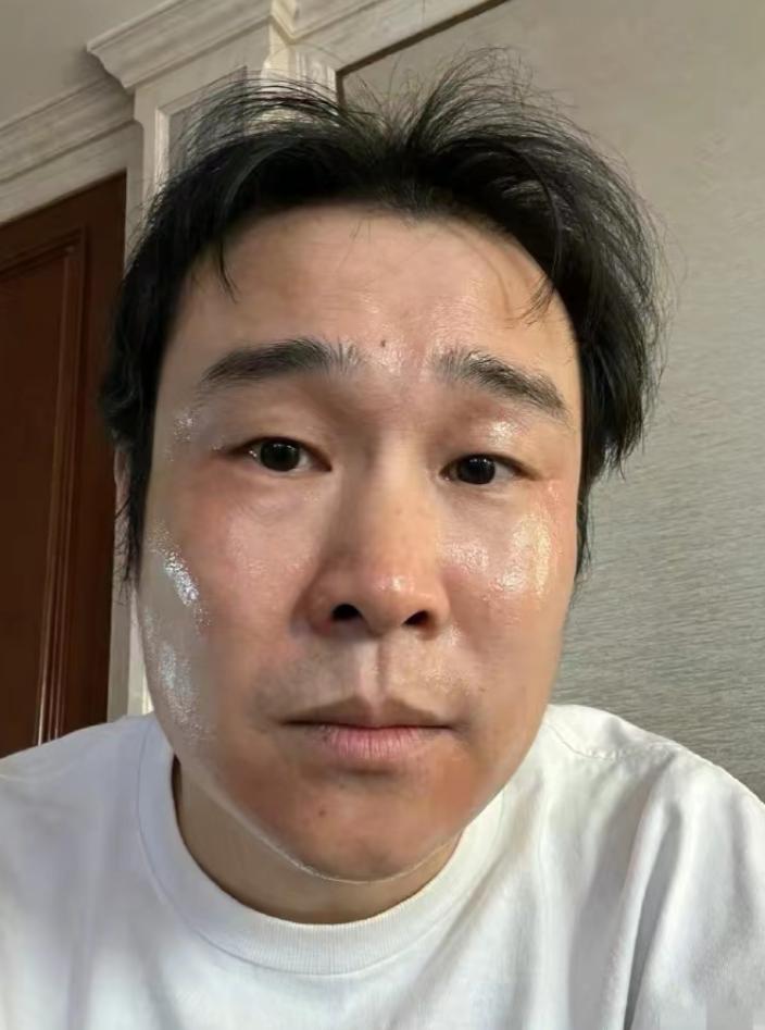 张靓颖|岳云鹏阳了成放屁大王，杨颖因逛夜店变阳，张靓颖为演出主动求阳