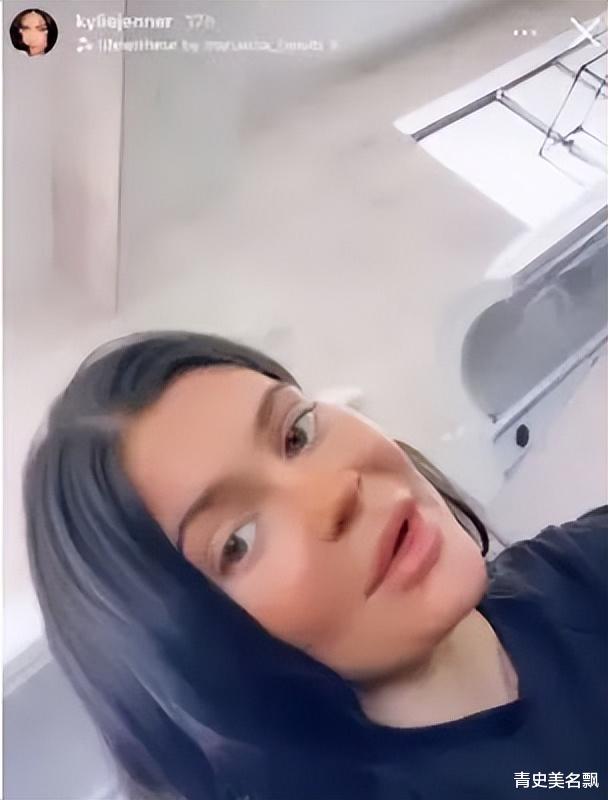 产后恢复|卡戴珊家族最美女人曝产后肚皮松垮难恢复：这才是产后正常的样子