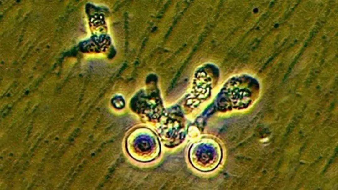 韩国一男子经水感染“食脑变形虫”身亡！自来水中会有食脑虫吗？