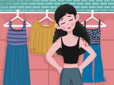 美颜|牛皮癣在生活上有什么需要注意什么,牛皮癣患者初期应了解哪些常识呢