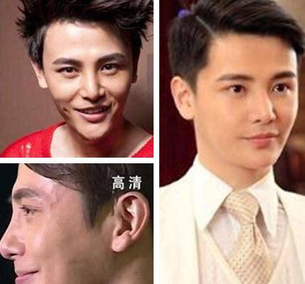 整容|明星“假鼻子”大PK，帅哥变丑男，美女变女巫，谁越整越残？