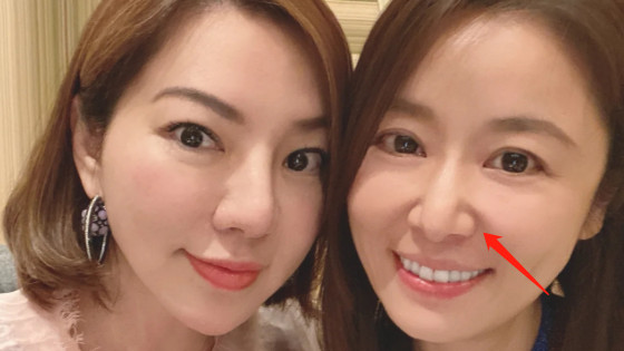 林心如|林心如素颜与网红合影，鼻子怪变歪被疑整容，华哥憔悴不如服务员