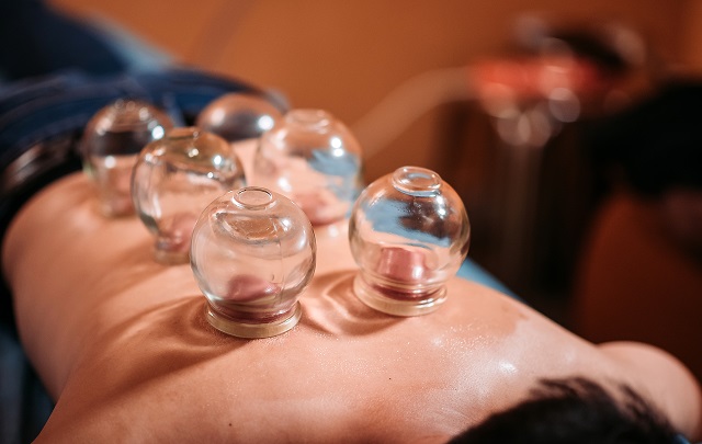 中成药|拔罐后背上的青紫，真的是“毒素”吗？一次全部告诉你