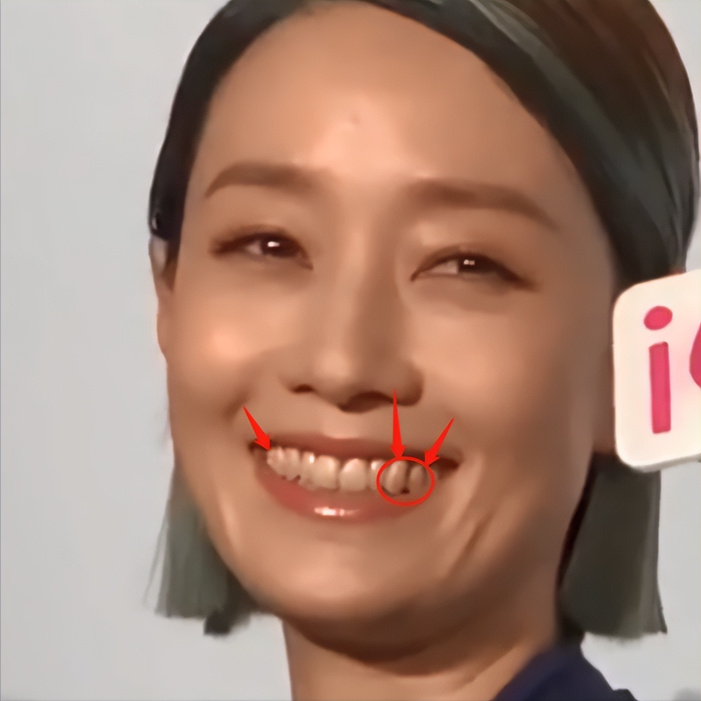 马伊琍|40岁的马伊俐最想删图片曝光,黄牙污垢明显。网友: 太恶心了